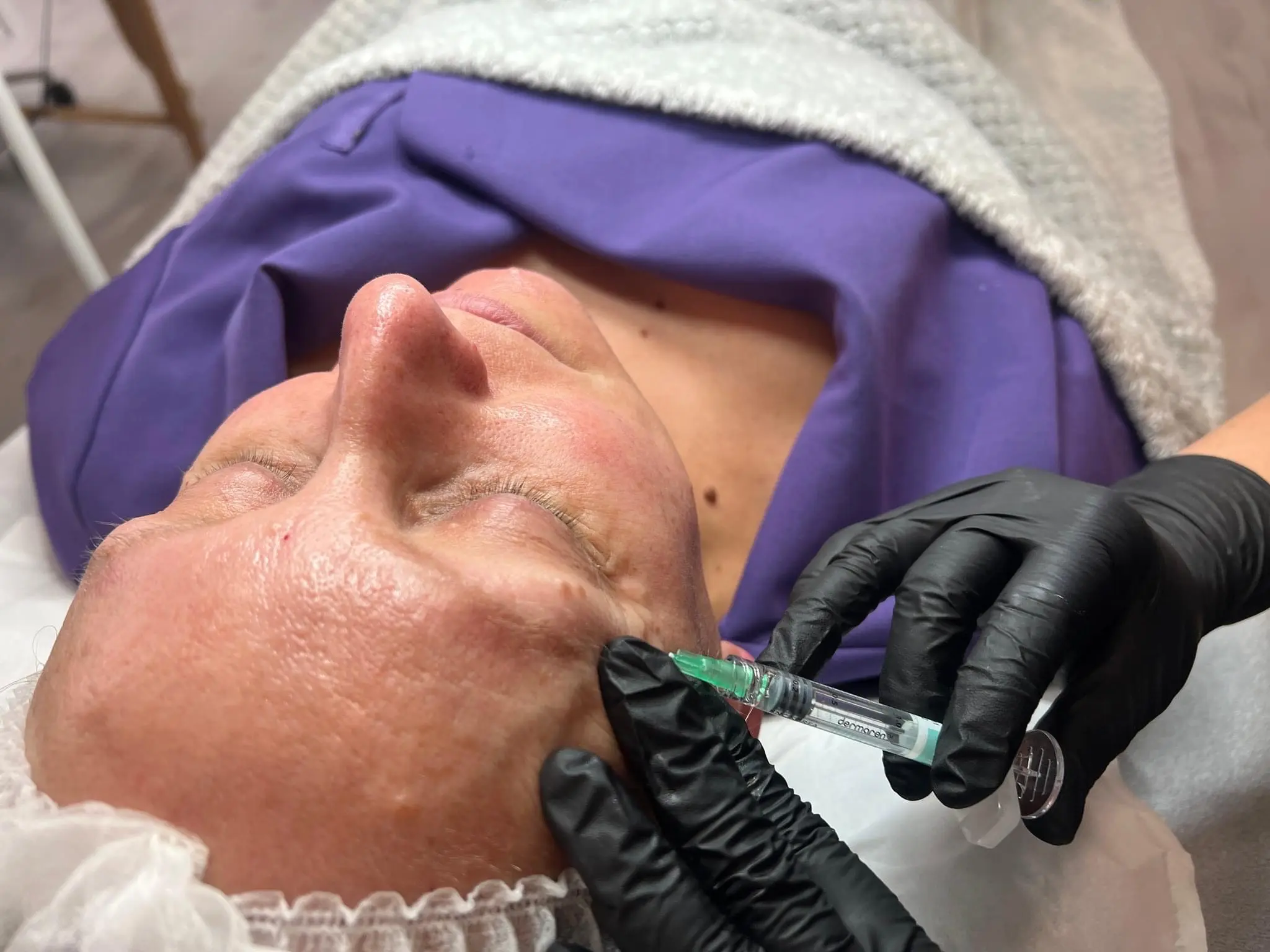 Hydrafacial