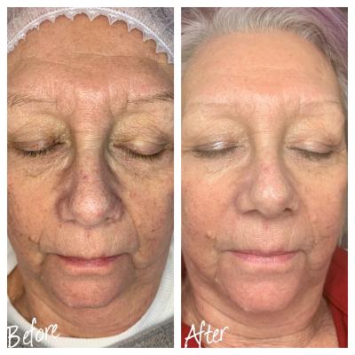 apollo-duet-6-sessions