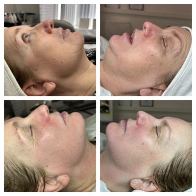 apollo-duet-2-sessions