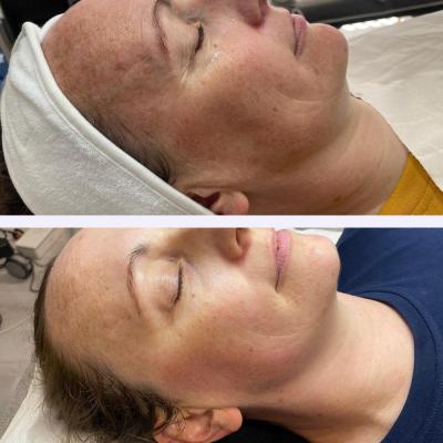 apollo-duet-3-sessions