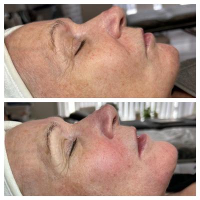 apollo-duet-2-sessions